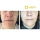 Slider image (9) CELAM Centro Laser Medico for Aesthetic Wellness